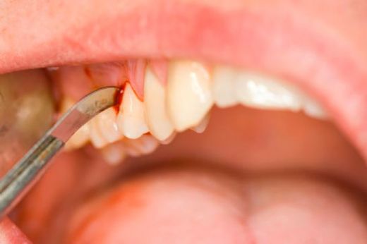 Rüyada Çocuk Dişi Görmek Rüya Yorumu ve Anlamı