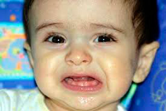 Rüyada Diş Çıkarmak Rüya Yorumu ve Anlamı