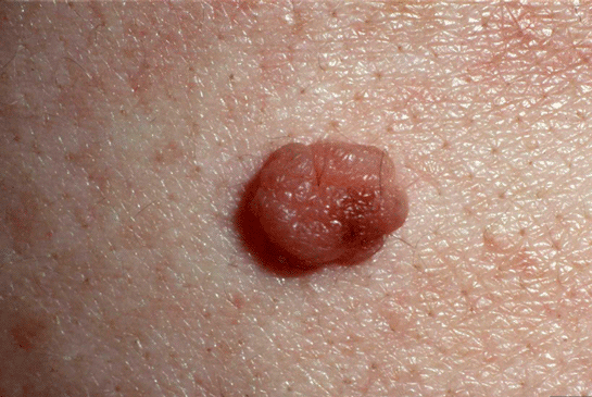 Rüyada Et Beni Görmek