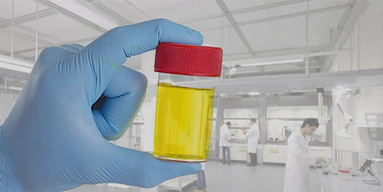 Rüyada İdrar Yapmak Rüya Yorumu ve Anlamı