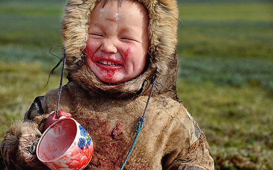 Rüyada Yüzünde Kan Görmek Rüya Yorumu ve Anlamı